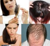 Hair Serum Glanz Anti Hair Fall.jpg