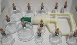 bekam 12 pc 1.jpeg